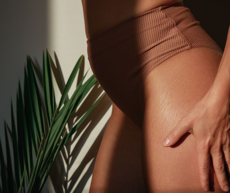 morphotype endomorphe stockage des graisses